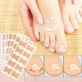 Toe Align Ingrown Nail Corrector Stickers